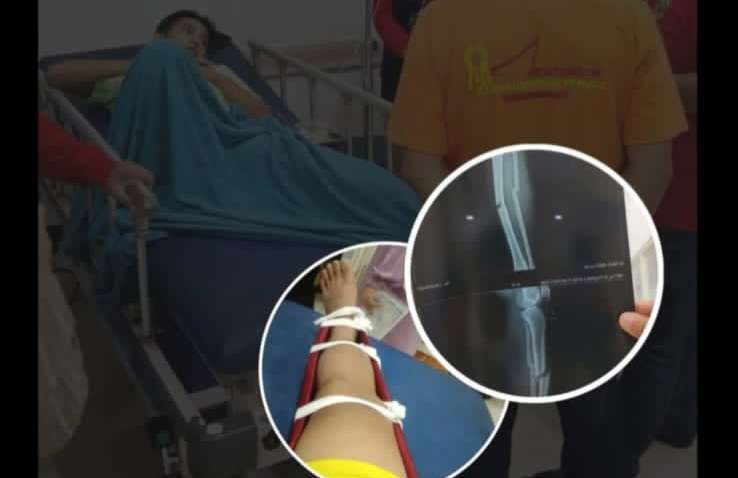 Atlet Futsal OKU Patah Kaki Akibat Insiden Brutal di Porprov Korpri