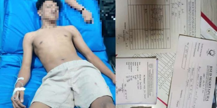 RSUD Martapura Jadi Sorotan, Kuitansi Tagihan Beredar Usai Direktur Janji Perawatan Gratis