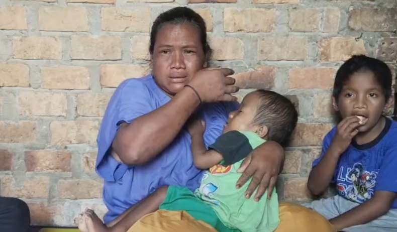 Nasib Pilu Bocah Miskin di OKU Timur, Alami Pengapuran Tulang Keluarga Bingung Biaya Berobat